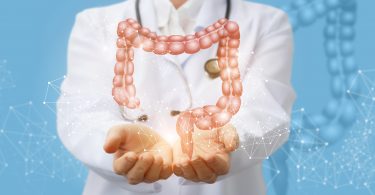 Cancer du côlon