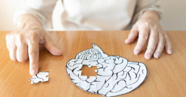 Alzheimer