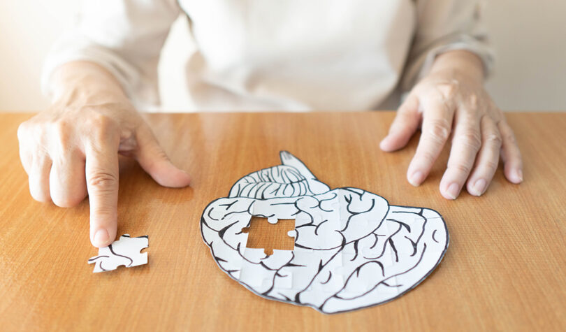 Alzheimer